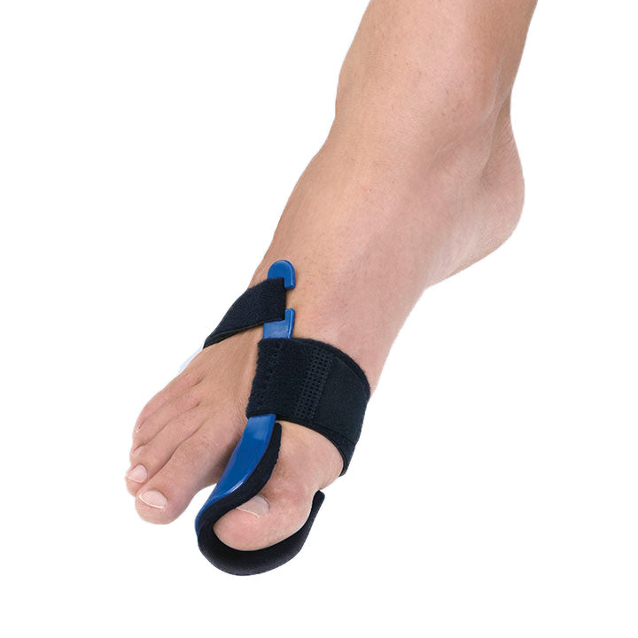 Orthèse Hallux Valgus En Thermoplastique Bleu Pour Aligner L'orteil Atteint D'un Oignon Au Pied